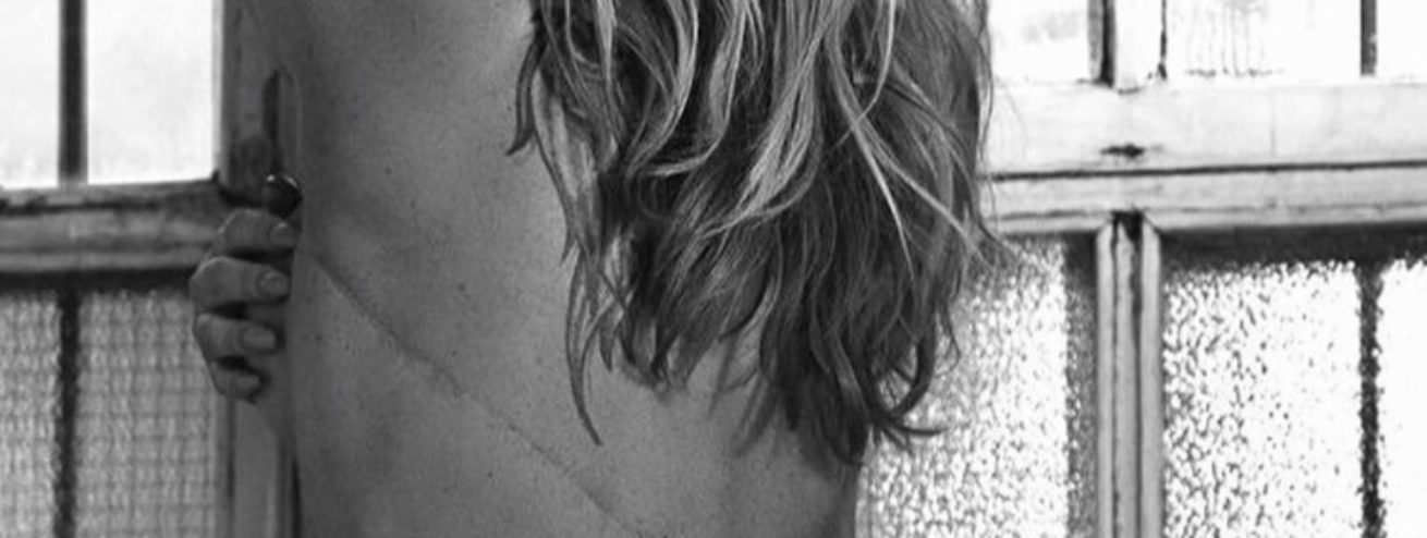 Anastacia posa mostrando le sue cicatrici per Fault Magazine