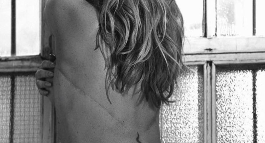 Anastacia posa mostrando le sue cicatrici per Fault Magazine